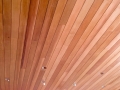 TustinRemodel-10