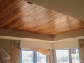 TustinRemodel-18